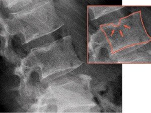 290895_20111126153504